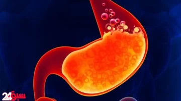 انخفاض حمض المعدة خطر يهدد صحتك بصمت.. اكتشف أعراضه وطرق علاجه